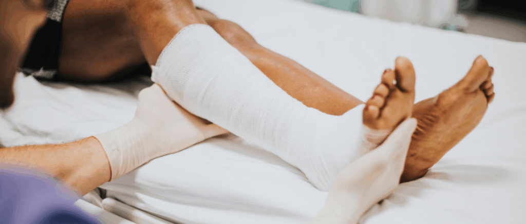 VA Disability Rating for Tibial Nerve Paralysis