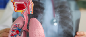 PACT Act respiratory benefits denied